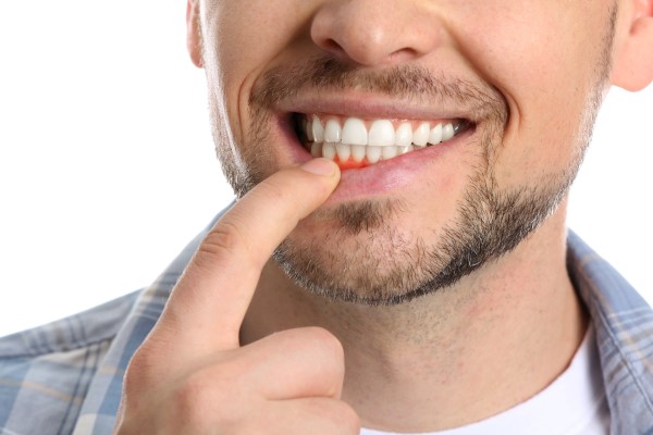 The Importance Of Periodontal Gum Disease Treatment